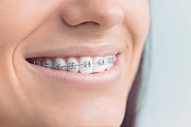 Why Choose Us for Your Dental Needs in Holladay, UT